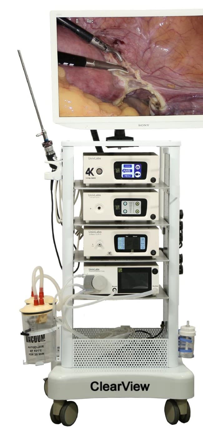 ClearView 4K Laparoscopy Tower